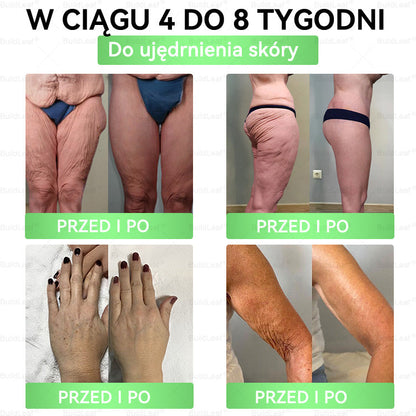 🇵🇱🔥𝖮𝖋𝗶𝗰𝗷𝗮𝗹𝗻𝘆 𝘀𝗸𝗹𝗲𝗽 | 👩‍⚕️𝘽𝙪𝙞𝙡𝙙𝙇𝙚𝙖𝙛® 𝗚𝗟𝗣-𝟭 𝟖-w-𝟭 Smukły i zdrowy roztwór doustny (𝑟𝑎𝑧 𝑑𝑧𝑖𝑒𝑛𝑛𝑖𝑒, 𝑟𝑒𝑧𝑢𝑙𝑡𝑎𝑡𝑦 𝑤 7 𝑑𝑛𝑖),Wspiera odchudzanie, serce, cukrzycę, sen, jelita, stawy, a także ujędrnia skórę i dodaje energii